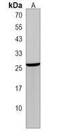 WFDC1 Rabbit Polyclonal Antibody