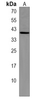 CHMP6 Antibody