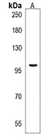 ZNF845 Antibody