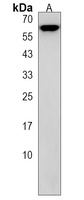 TBC1D3F Rabbit Polyclonal Antibody