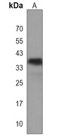 CCNYL3 Rabbit Polyclonal Antibody
