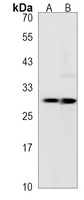 TCRB Rabbit Polyclonal Antibody