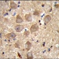 Anti-PCDHAC2 Antibody