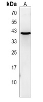 POTEKP Rabbit Polyclonal Antibody
