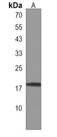 ZNF593 Antibody