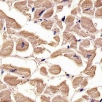 TUBA1C Rabbit Polyclonal Antibody