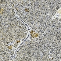 Anti-IL-17B Antibody
