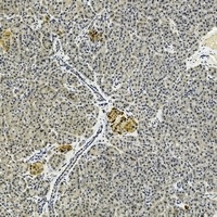 Anti-IL-17B Antibody