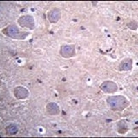 SmgGDS Rabbit Polyclonal Antibody