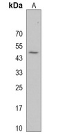 TMPRSS11E Rabbit Polyclonal Antibody