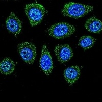 Anti-PABPN1L Antibody