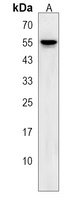 SHISA6 Rabbit Polyclonal Antibody