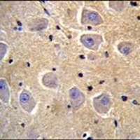SHISA6 Rabbit Polyclonal Antibody