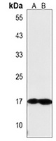 FGF16 Rabbit Polyclonal Antibody