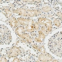 Anti-Collagen 8 alpha 2 Antibody