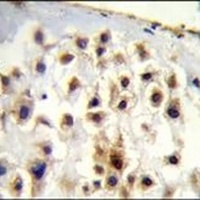 Collagen 13 alpha 1 Antibody