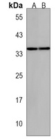 KCNRG Antibody