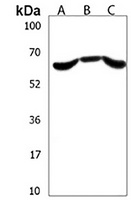 PALM3 Rabbit Polyclonal Antibody