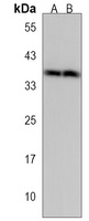 CELF6 Rabbit Polyclonal Antibody