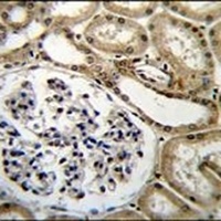 CELF6 Rabbit Polyclonal Antibody