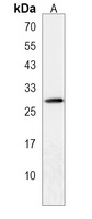 JAZF1 Rabbit Polyclonal Antibody