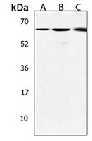 PLAG1 Rabbit Polyclonal Antibody