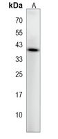 CD85f Rabbit Polyclonal Antibody