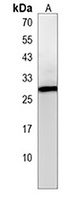 HIDE1 Antibody