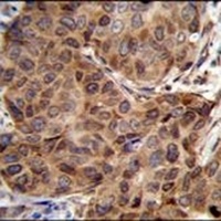 Anti-SNX24 Antibody