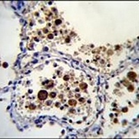 Anti-Siglec 15 Antibody