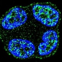 Anti-SCUBE2 Antibody