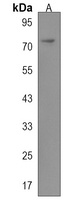 CPT1C Antibody