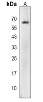 KRBA2 Rabbit Polyclonal Antibody