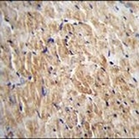 KRBA2 Rabbit Polyclonal Antibody