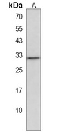OR5B12 Rabbit Polyclonal Antibody
