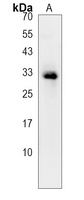 OR2B11 Rabbit Polyclonal Antibody