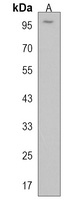 FAM160B1 Antibody