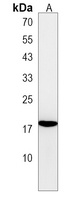 FAM218A Rabbit Polyclonal Antibody