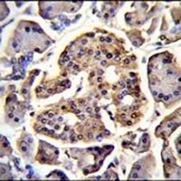 FAM218A Rabbit Polyclonal Antibody