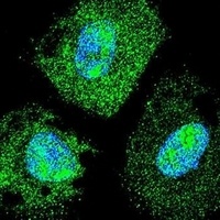 FAM218A Rabbit Polyclonal Antibody