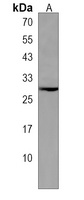 ARL5B Antibody
