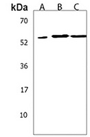 PIP5KL1 Antibody