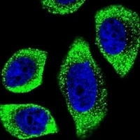 Anti-PIP5KL1 Antibody