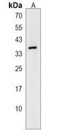 PIH1D2 Antibody