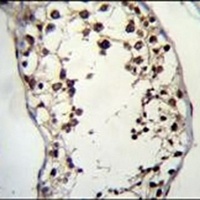 PIH1D2 Antibody