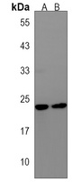 Phospholipase D6 Rabbit Polyclonal Antibody