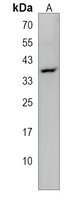 NUDT22 Rabbit Polyclonal Antibody