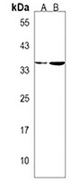 OR10J5 Antibody
