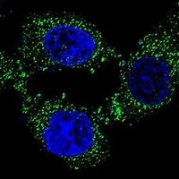 Anti-C4orf21 Antibody