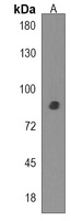 SPATA5L1 Rabbit Polyclonal Antibody